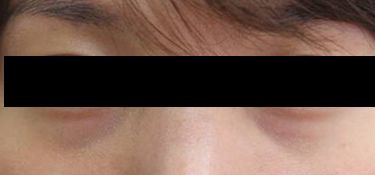 25대 여자 before