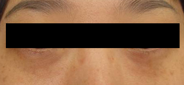 23세 여자 before