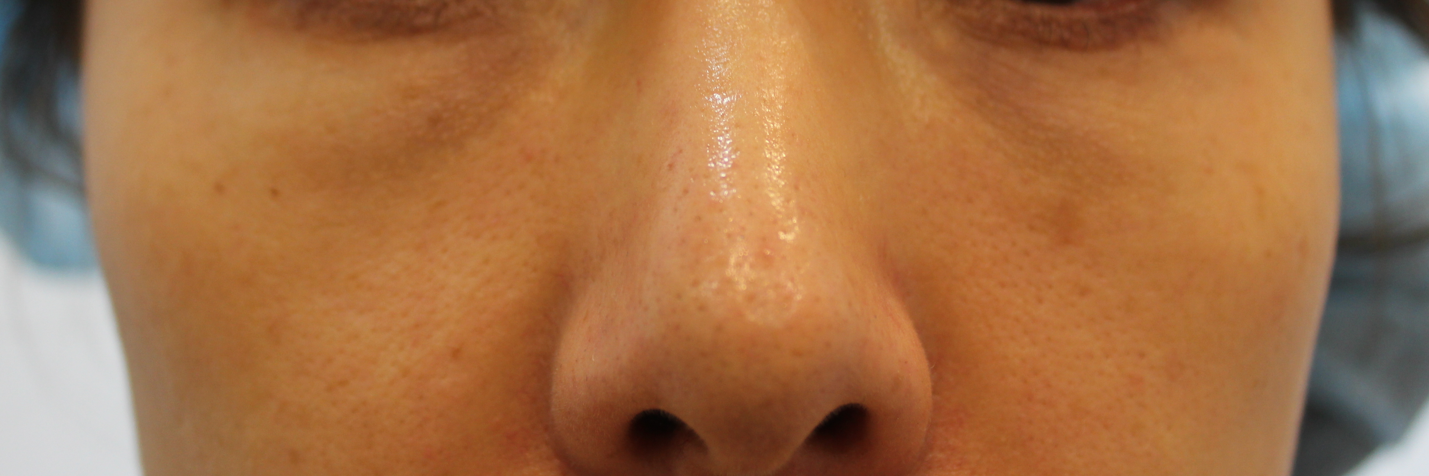23세 여자 before