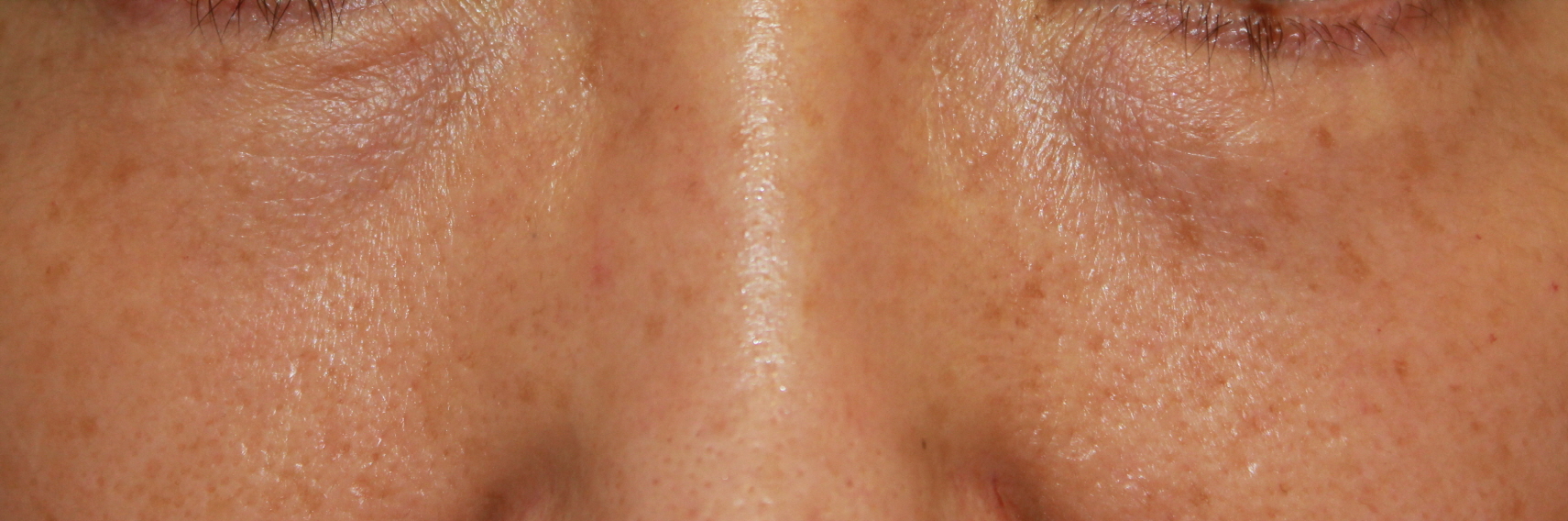 23세 여자 before