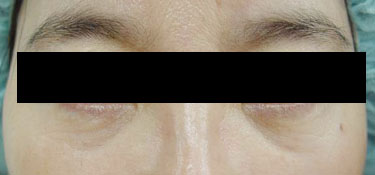 23세 여자 before