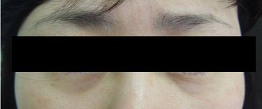 23세 여자 before