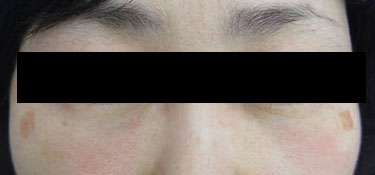 23세 여자 after