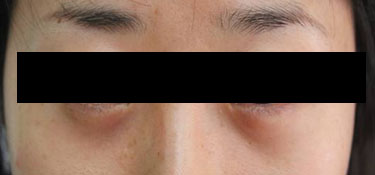23세 여자 before