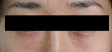 23세 여자 after